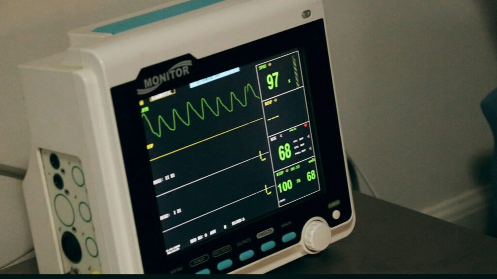 Electrocardiograma